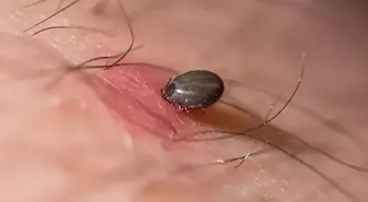 Kene ısırığı sonucu Kırım Kongo Kanamalı Ateşi'ne yakalanan adam hayatını kaybetti