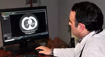Kurban Bayramı'nda Kist Hidatiği Riskine Dikkat!