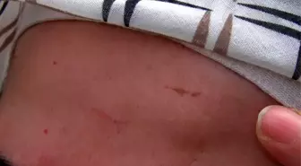 Ankara'da Bayram Günü Komşu Kavgası: Kadın Darp Edildi