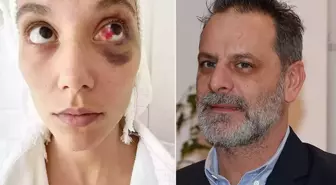 Ozan Güven'e 'kasten yaralama' suçundan hapis cezası