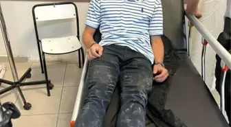 Kastamonu'da Başını Boş Köpekten Kaçamadı: Motosikletli Kurye Yaralandı