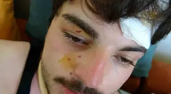 Bahar Dizisi Oyuncusu Mehmet Akif Akdeniz Trafikte Darbedildi