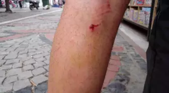Edirne'de Sokak Köpeklerinin Saldırısına Uğrayan Adamın Korkunç Anları