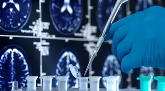 Alzheimer'a virüsler mi yol açıyor?