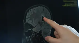 Serebral Palsi: Belirtileri ve Cerrahi Tedavi Yöntemleri