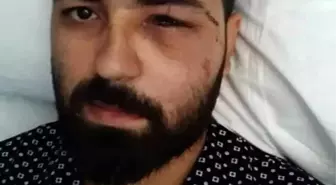 15 Temmuz Gazisi Akkoç'un İfadesi