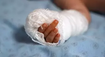 Hemşire, serumu çıkarırken bebeğin parmağını kopardı