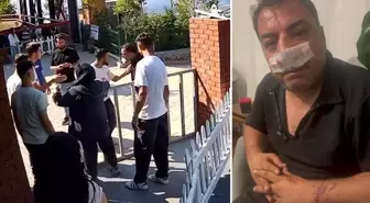Turistlerden 4 fotoğraf için servet istediler, kavgada araya giren şoförün burnunu kırdılar