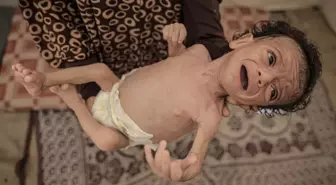 24 saatte 6 kişi daha açlıktan öldü, 7 aylık Salim bebeğin hayatı tehlike altında