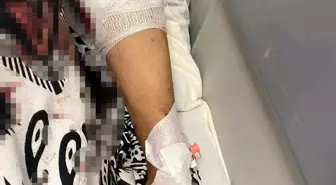 Su Kesintisi Sırasında Köpek Saldırısına Uğrayan Kadın Hastaneye Kaldırıldı