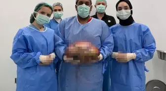 Şişlik yüzünden gitti, karnından çıkan doktorları bile şoke etti