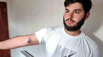 Adana'da Top Almak İsteyen Aileye Sopa ve Silahlı Saldırı