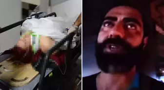 Eski sevgilisini vuran şüpheli saldırı öncesi video çekmiş: Hakkınızı helal edin