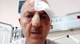 Boşanma Aşamasındaki Adam Kayınbiraderinin Saldırısına Uğradı