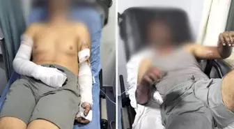 Manisa'da Sanayi Sitesinde Patlama: 2 Yaralı