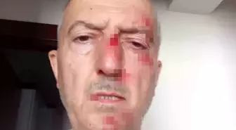 Afyonkarahisar'da Boşanma Sürecinde Darp Edilen Şahıs Hastanelik Oldu