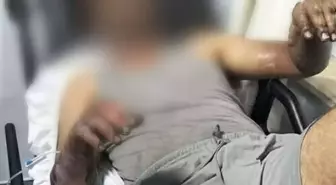 Manisa'da Oto Tamirhanesinde Patlama: 2 Yaralı
