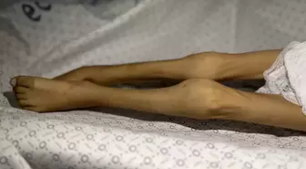 Gazze Şeridi'nde bir çocuk daha "açlıktan" öldü! 3 kiloya kadar düşmüştü