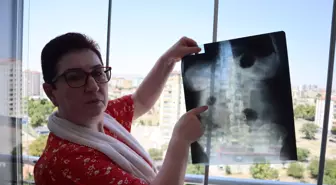 22 Yıldır Karnında Ameliyat İğnesiyle Yaşayan Kadın: 'Yaşayan Ölü Gibiyim'