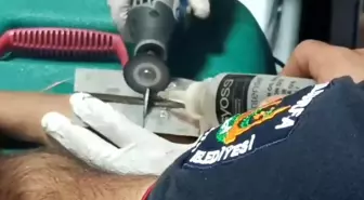 Şanlıurfa'da 10 Yaşındaki Çocuğun Parmağındaki Cıvata Pulu İtfaiye Ekipleri Tarafından Çıkarıldı