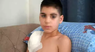 Sahipli Köpek Saldırısı 11 Yaşındaki Çocuğun Hayatını Kabusa Çevirdi
