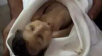 Gazze'de Açlık Sebebiyle Bir Bebek Daha Hayatını Kaybetti