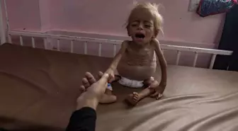 Gazze'de Kıtlık: Son 24 Saatte 8 Filistinli Açlık Nedeniyle Hayatını Kaybetti