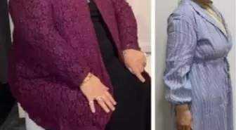 54 Yaşındaki Kadın 35 Kilo Vererek Sağlığına Kavuştu