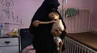 Gazze'de Açlık ve Yetersiz Beslenme Nedeniyle 4 Sivil Hayatını Kaybetti