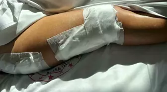 Yalova'da Tekne Çarpması Sonucu 70 Yaşındaki Kadın Ağır Yaralandı
