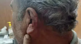 Denizli'de Aile Hekimi ile Emekli Öğretmen Arasında Kavga