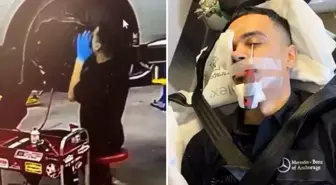 Otomobil tamirinde korkutan kaza! İşçinin gözüne tornavida saplandı