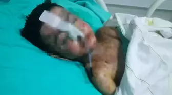 Salatalık yutunca öksürmeye başlayan çocuğun vücudunda kateter unutulduğu ortaya çıktı