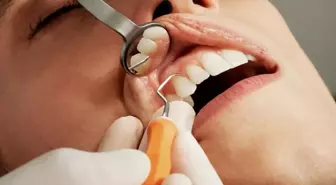 Dökülen dişleri yeniden çıkartan ilaç geliştirildi