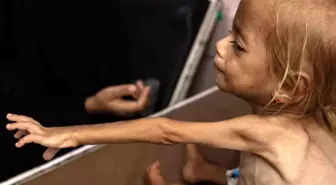 Gazze Şeridi'nde Son 24 Saatte 5 Sivil Açlık Nedeniyle Hayatını Kaybetti
