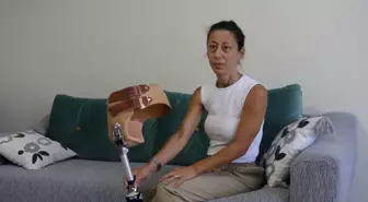 Kemik Kanseriyle Mücadele Eden Anne, Yeni Protez İçin Destek Bekliyor