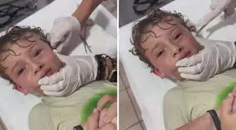'Kafamın içinde bir şey kıpırdıyor' diyen çocuğun kulağından yengeç çıktı