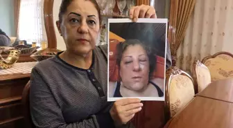 Ankara'da Komşu Kavgası: Kadına Saldırı, Burnu Kırıldı