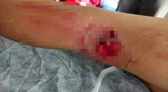 Orhangazi'de 8 Yaşındaki Çocuğa Köpek Saldırdı