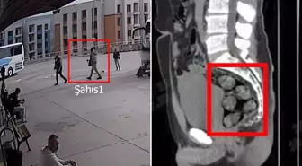 Tomografideki görüntü şoke etti! Zehir tacirleri yakayı böyle ele verdi