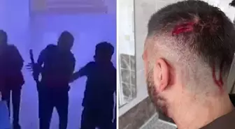 Öğretmene veliden sopalı saldırı