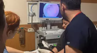 Zihinsel Engelli Kadının Yemek Borusuna Kaçan Ceviz Başarıyla Çıkarıldı