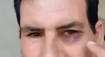 Sosyal Medyada Hakaret Eden Şüpheli Tutuklandı