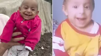 'Gülen Bebek' olarak tanınan Ökkeş Bebek hayatını kaybetti