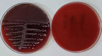 Karabük Üniversitesi'nden Enfeksiyon Riskini Azaltan Yenilikçi Implant Yöntemi