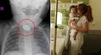 Kardeşi fark etti, hastaneye koştular! 15 aylık bebeğin yemek borusundan çıkanlar şoke etti