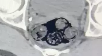 Iğdır'da Uyuşturucu Operasyonu: 140 Gram Metamfetamin Ele Geçirildi