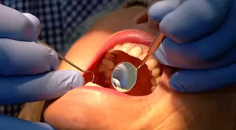 Nottingham Üniversitesi'nden Diş Minesini Yenileyen Yeni Jel Geliştirildi
