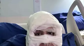 Kadıköy'de Ateşe Verilen Kadın Ağır Yaralandı