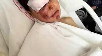 Aksaray'da Bisikletliye Otomobil Çarptı, Sürücü Kaçtı